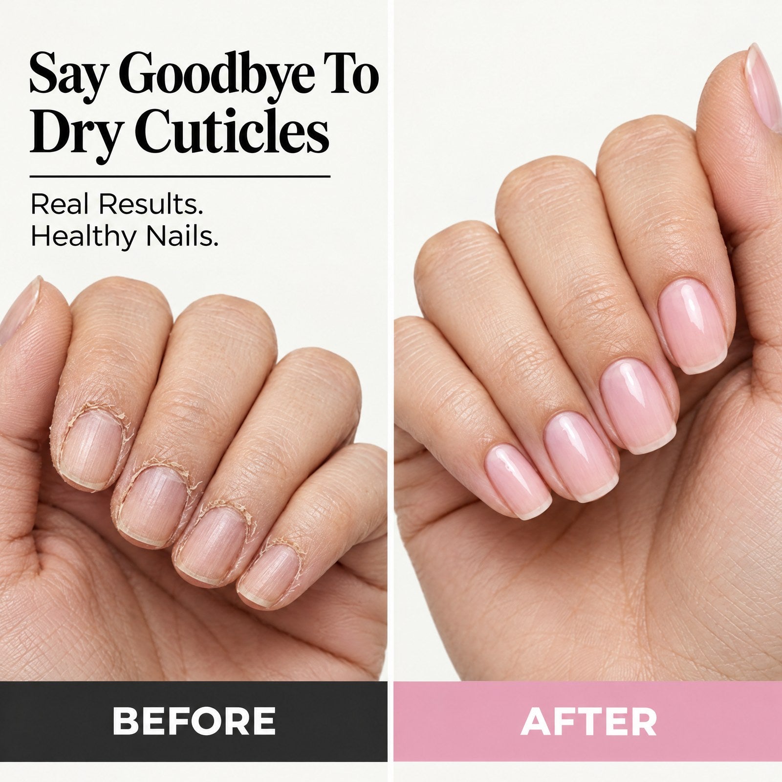 Say goodbye to dry cuticles
